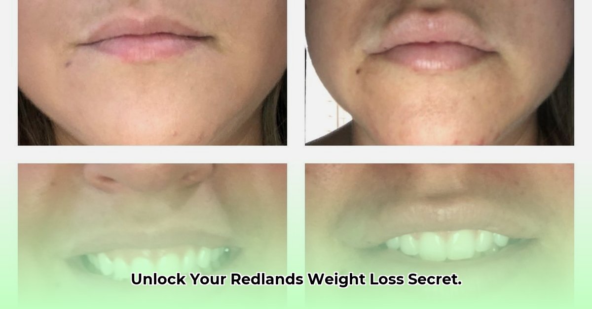weight-loss-redlands-ca